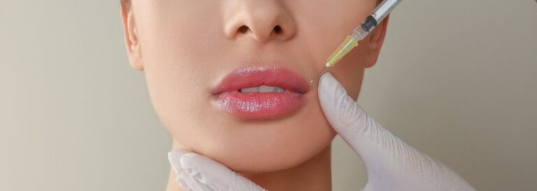 lip filler