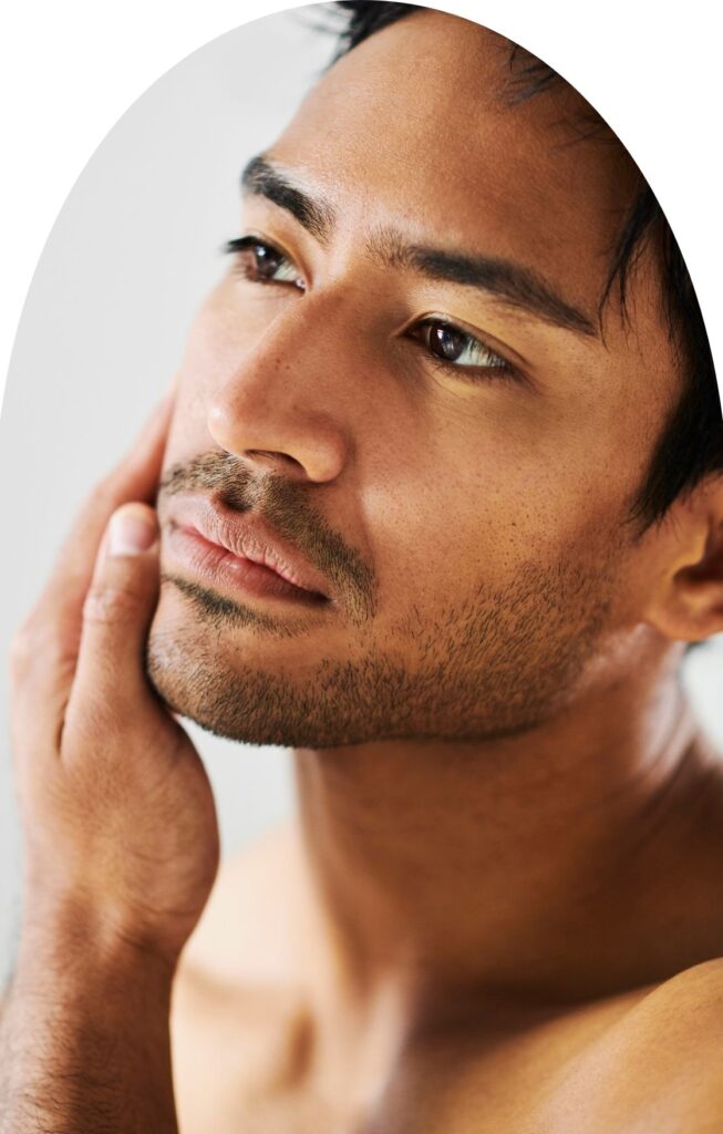 skinpen microneedling