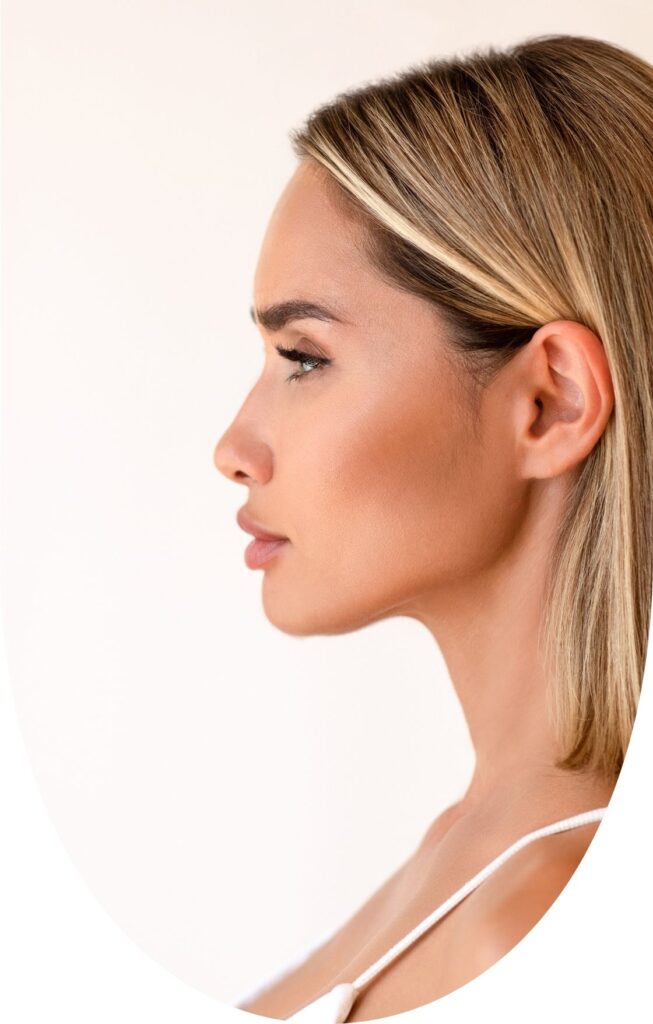 dermal filler
